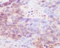 Anti-IgG4 IGHG4 Rabbit Monoclonal Antibody
