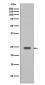 Anti-Rab9 RAB9A Rabbit Monoclonal Antibody