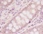 Anti-M6PR IGF2R Rabbit Monoclonal Antibody