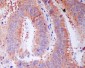 Anti-RPS3/Ribosomal Protein S3 Rabbit Monoclonal Antibody