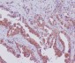 Anti-SGK1/Sgk Rabbit Monoclonal Antibody