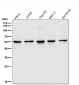 Anti-SGK1/Sgk Rabbit Monoclonal Antibody