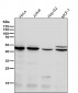 Anti-Chk1 CHEK1 Rabbit Monoclonal Antibody