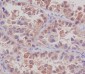 Anti-MSI2/Musashi 2 Rabbit Monoclonal Antibody