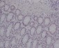 Anti-Ku80 XRCC5 Rabbit Monoclonal Antibody