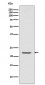 Anti-TMS1 PYCARD Rabbit Monoclonal Antibody