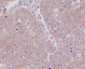 Anti-GART Rabbit Monoclonal Antibody