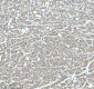 Anti-CPT2 Rabbit Monoclonal Antibody