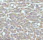 Anti-CPT2 Rabbit Monoclonal Antibody
