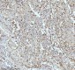 Anti-CPT2 Rabbit Monoclonal Antibody