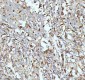 Anti-CPT2 Rabbit Monoclonal Antibody