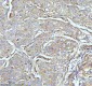 Anti-CPT2 Rabbit Monoclonal Antibody