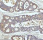 Anti-CPT2 Rabbit Monoclonal Antibody