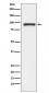 Anti-TOP1/Topoisomerase I Rabbit Monoclonal Antibody