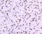 Anti-TOP1/Topoisomerase I Rabbit Monoclonal Antibody