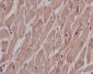 Anti-SHP2 PTPN11 Rabbit Monoclonal Antibody