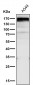 Anti-RelB Rabbit Monoclonal Antibody