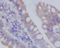 Anti-RAB7 RAB7A Rabbit Monoclonal Antibody