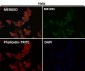 Anti-CDK8 Rabbit Monoclonal Antibody