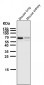 Anti-CDK8 Rabbit Monoclonal Antibody