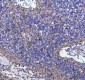 Anti-ATPB Rabbit Monoclonal Antibody