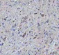 Anti-ATPB Rabbit Monoclonal Antibody