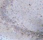 Anti-ATPB Rabbit Monoclonal Antibody