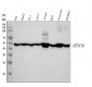 Anti-ATPB Rabbit Monoclonal Antibody
