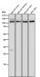Anti-CD26/DPP4 Rabbit Monoclonal Antibody