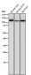 Anti-CD26/DPP4 Rabbit Monoclonal Antibody