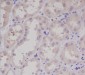 Anti-S100 S100A1 Rabbit Monoclonal Antibody