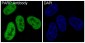 Anti-PARP PARP1 Rabbit Monoclonal Antibody
