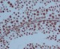 Anti-PARP PARP1 Rabbit Monoclonal Antibody