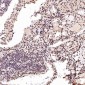 Anti-PARP PARP1 Rabbit Monoclonal Antibody