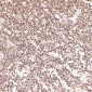Anti-PARP PARP1 Rabbit Monoclonal Antibody