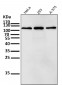 Anti-RNF20 Rabbit Monoclonal Antibody