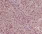 Anti-Smad4 Rabbit Monoclonal Antibody