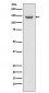 Anti-TACC3 Rabbit Monoclonal Antibody