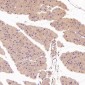 Anti-S100B/S100 Beta Rabbit Monoclonal Antibody