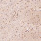 Anti-S100B/S100 Beta Rabbit Monoclonal Antibody
