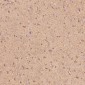 Anti-S100B/S100 Beta Rabbit Monoclonal Antibody