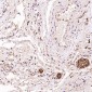 Anti-S100B/S100 Beta Rabbit Monoclonal Antibody