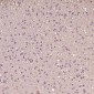 Anti-S100B/S100 Beta Rabbit Monoclonal Antibody