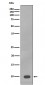 Anti-S100B/S100 Beta Rabbit Monoclonal Antibody