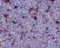 Anti-MERTK/Mer Rabbit Monoclonal Antibody
