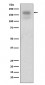 Anti-MERTK/Mer Rabbit Monoclonal Antibody