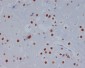Anti-STAT3 Rabbit Monoclonal Antibody