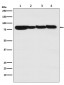 Anti-STAT3 Rabbit Monoclonal Antibody