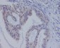 Anti-B Raf Rabbit Monoclonal Antibody