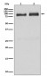 Anti-B Raf Rabbit Monoclonal Antibody